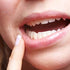 Causes of Gum Sensitivity