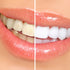 Is Teeth Whitening Safe to Use?